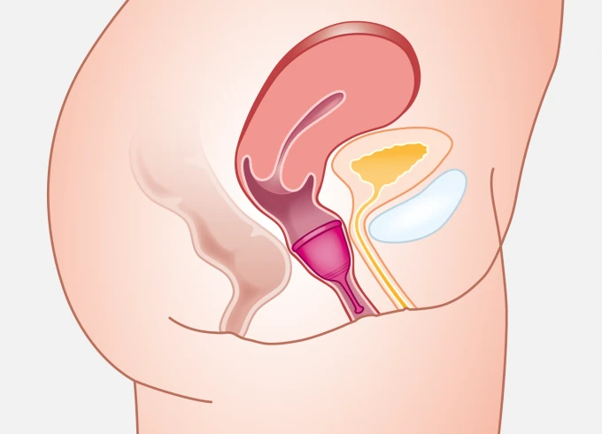Medintim Tulipa Menstrual Cup | Application | 02 Placing Properly | Made in Germany | Mens Health Downunder