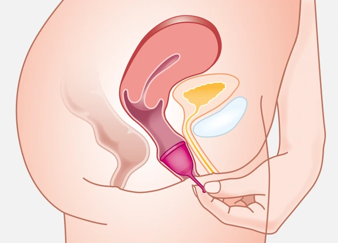 Medintim Tulipa Menstrual Cup | Application | 03 Removing | Made in Germany | Mens Health Downunder